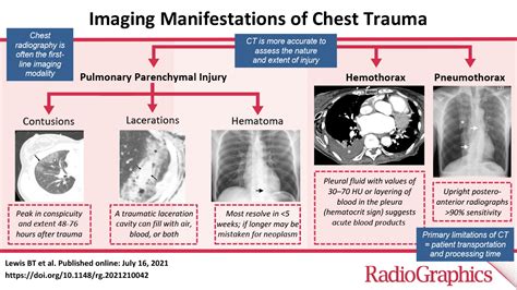 chest compression test trauma|pneumothorax and chest trauma.